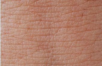 Wat is mijn huidtype? Zo kom je er achter. 